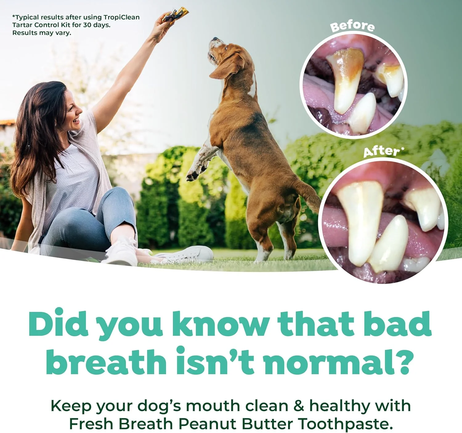 TropiClean Fresh Breath Oral Care Kit - Soft Bristle Finger Toothbrush - Dog Tooth Brushing Kit - - Image 4